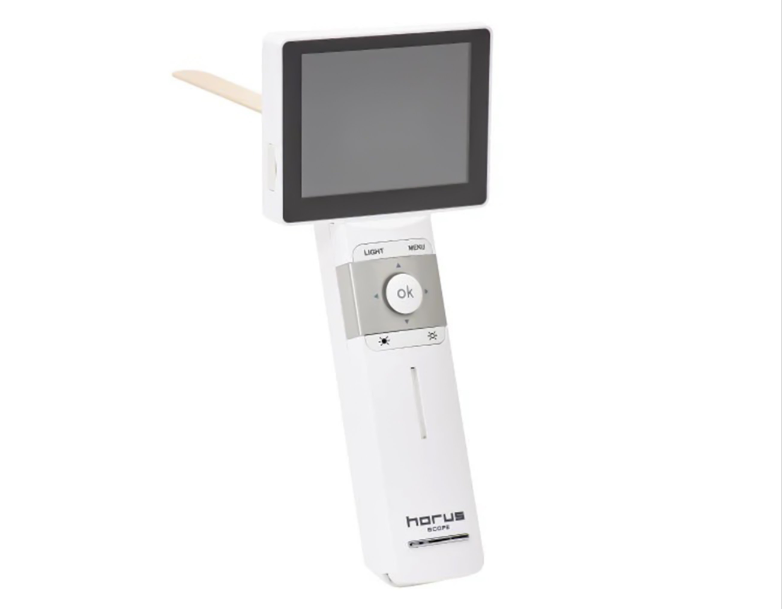 Digital Otoscope System Horus Series E With Camera - 39-7410