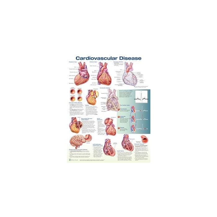 PocketNurse Cardiovascular Charts - CHART, CARDIOVASCULAR DISEASE, LAM ...