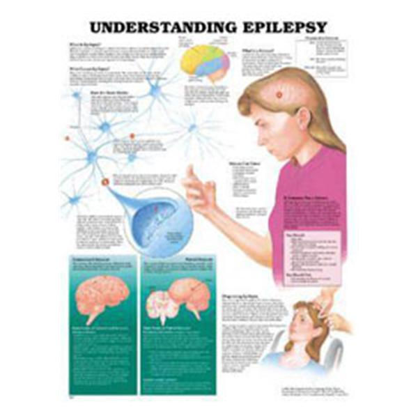 Wolters Kluwer Health  Chart Educational Understanding Epilepsy 20x26" EA