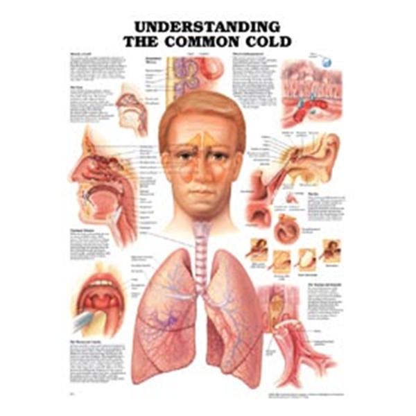 Common Cold Classification Wolters Kluwer Health Chart Educational Understanding The Common Cold ...