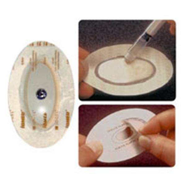 Patterson Med(Sammons Preston) Electrode Intphrs Imd Igl 11.2x11.2 Md Gl/Spng/Ag/AgCl 12/Pk