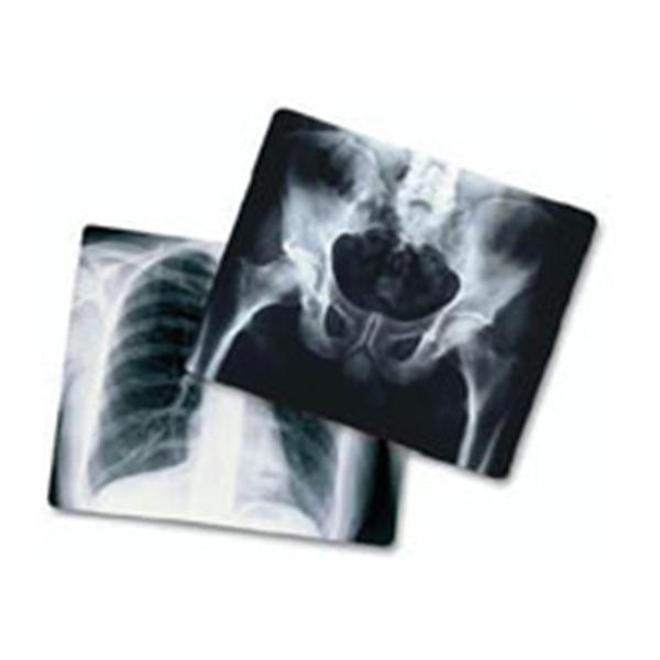 Medlink Imaging Film X-Ray AGFA Radiomat 14x35" 25/Bx