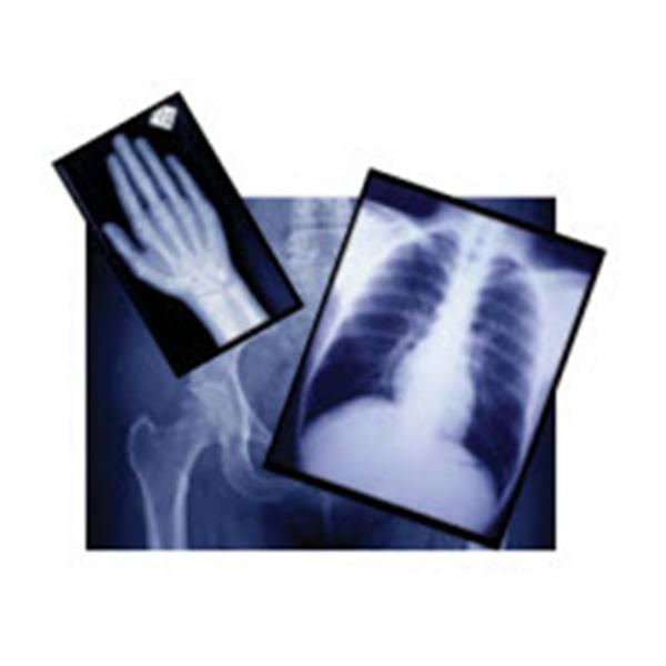 Agfa oration Film X-Ray Radiomat GPlus 24x30cm 100/Bx