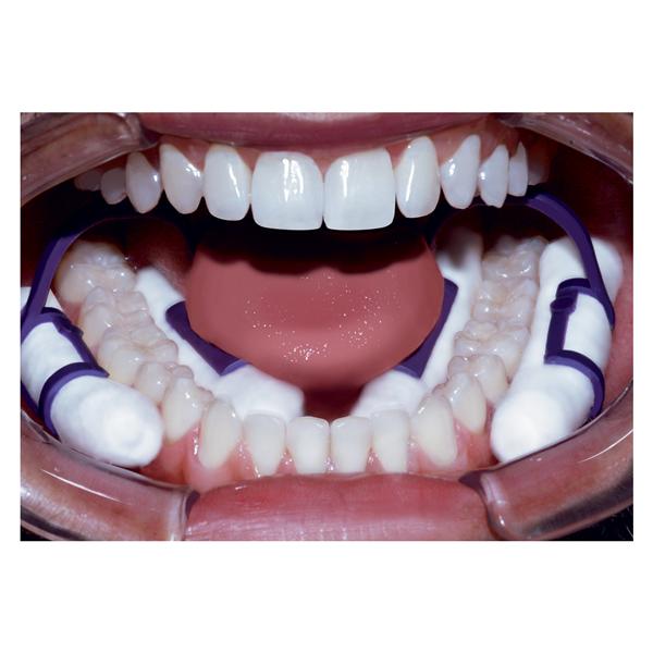 Pascal  Cotton Roll Holder Isolators Purple 50/Bx