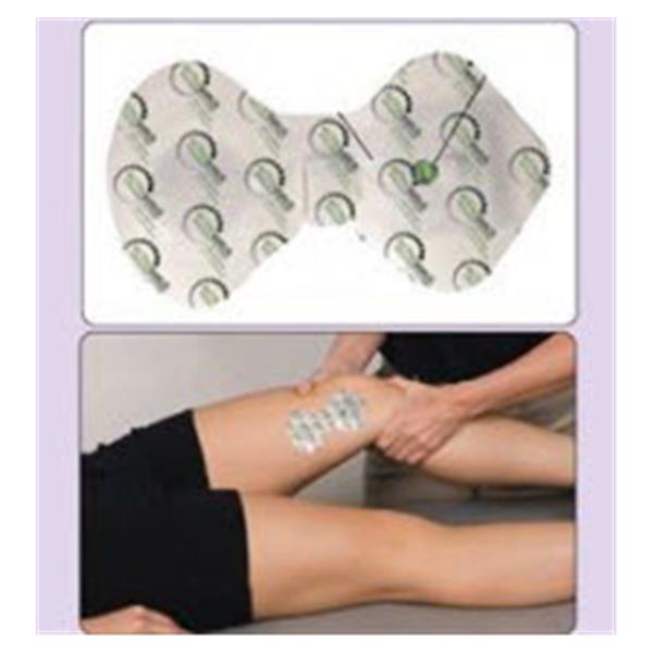 Activatek System Iontophoresis ActivaPatch 6/Bx — Grayline Medical
