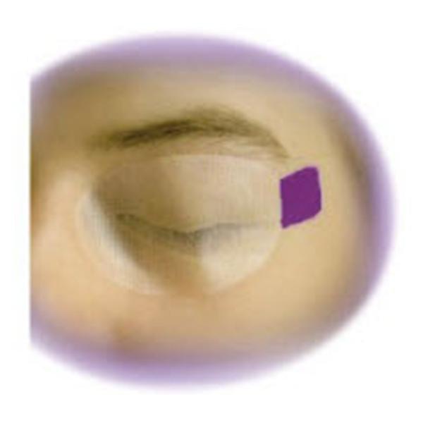 Sharn Guard Sharn Guard Surgical Eyegard Clear Disposable 50Pr/Bx (S2020-P ...