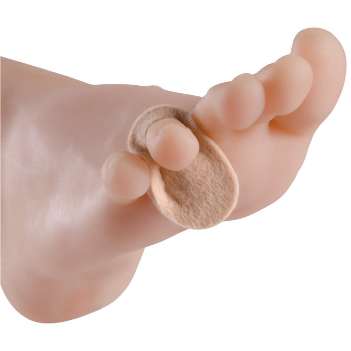 Stein's Wool Removable Corn Pads, 3/16"