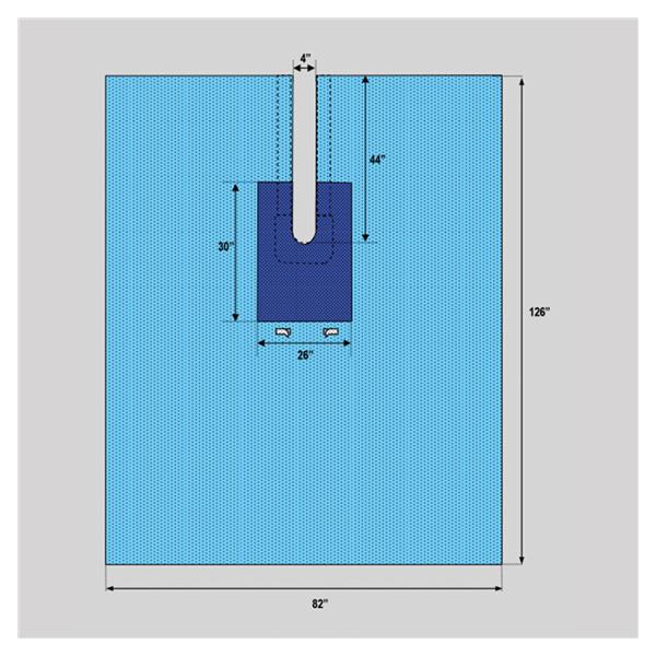 Welmed  Drape Surgical Fenestrated 82x126" Sterile 20/Ca