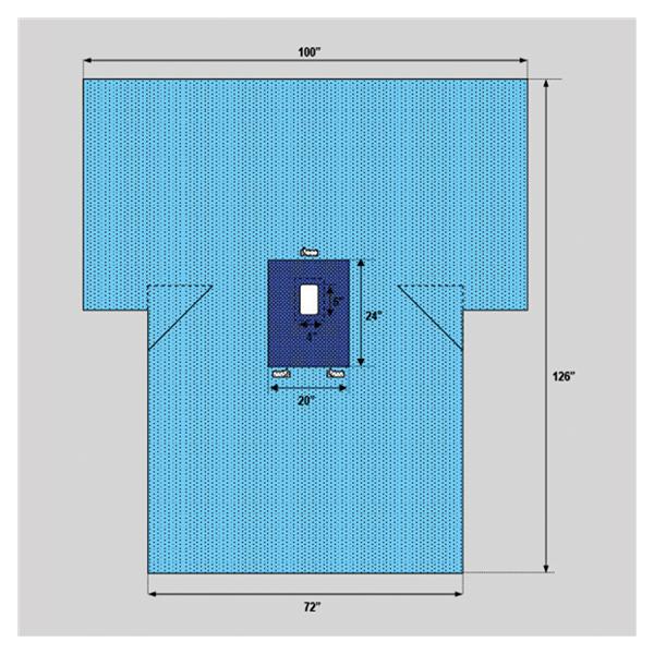 Welmed  Drape Laparotomy 4x6" Fenestrated 1x125" T-Style Sterile Ea, 20 EA/CA (1222-2126)