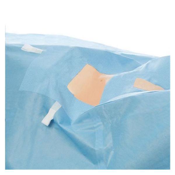 O & M Halyard Drape Laproscopy/Lithotomy Fenestrated 264x315cm Blue Strl 15/Ca