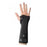 DJO Brace Fracture Exos Adult Short Arm Pink Size Small Right Ea (312-41-4444)