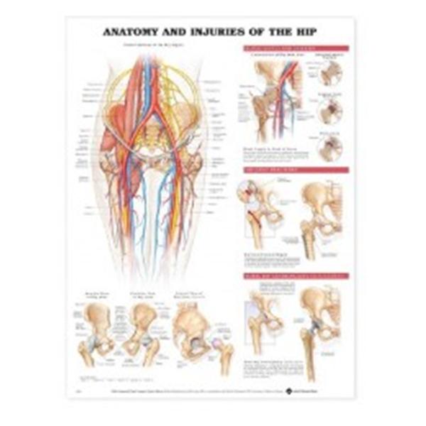 Wolters Kluwer Health  Chart Anatomical Injuries of the Hip 20x26" Ea
