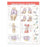 Wolters Kluwer Health  Chart Anatomical Athletic Injuries of The Knee 20x26" Ea