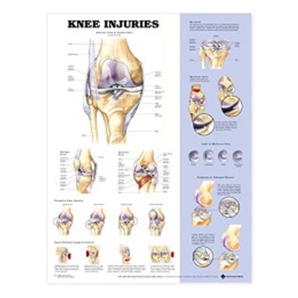 Wolters Kluwer Health  Chart Anatomical Knee Injuries Ea