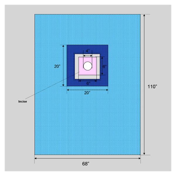 Welmed  Drape Sheet 4" Fenestrated 110x68" Blue Sterile 22/Ca