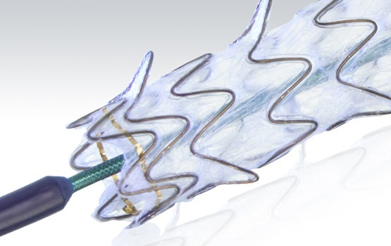 Conmed GORE VIABIL Biliary Stents - GORE, BILIARY, ENDOPROSTHESIS, 10MM X 60MM - VH1006200