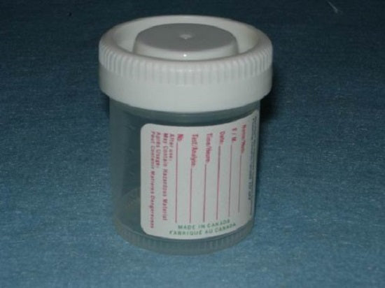 Starplex Histoplex O-Ring Containers 5ml-120ml - 40ML CLEAR, YELLOW SCREW CAP, NS - H402-FL