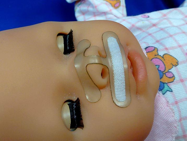 Westmed Septal-H Gentle Cannula Stabilization Devices - Septal-H Cannula Stabilization Device, Neonatal - CP-5410