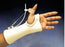 Thumb Extension Kit