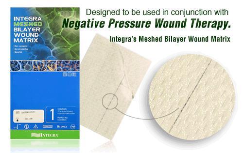 Integra Bilayer Wound Matrix System - Bilayer Wound System, Collagen and Silicone - BMW4051