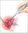 A&E Medical Suction Coagulator Cannula Tubing - Suction Coagulator, Foot Control - 050-030