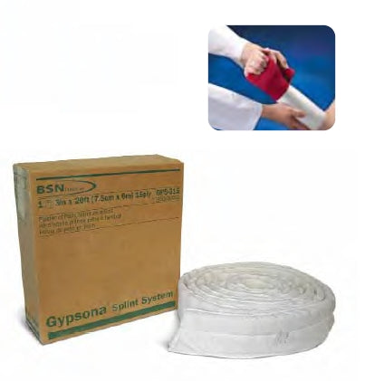BSN Gypsona Plaster Splinting System - Gypsona Plaster Splint Roll, 6" x 20' - GPS-615