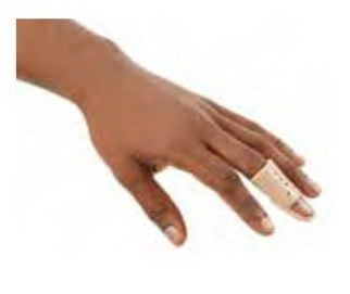 Breg Inc Stack Finger Splints - Stack Finger Splint, Size 1 - 100220-0 ...