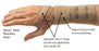 Elastic Wrist Orthosis