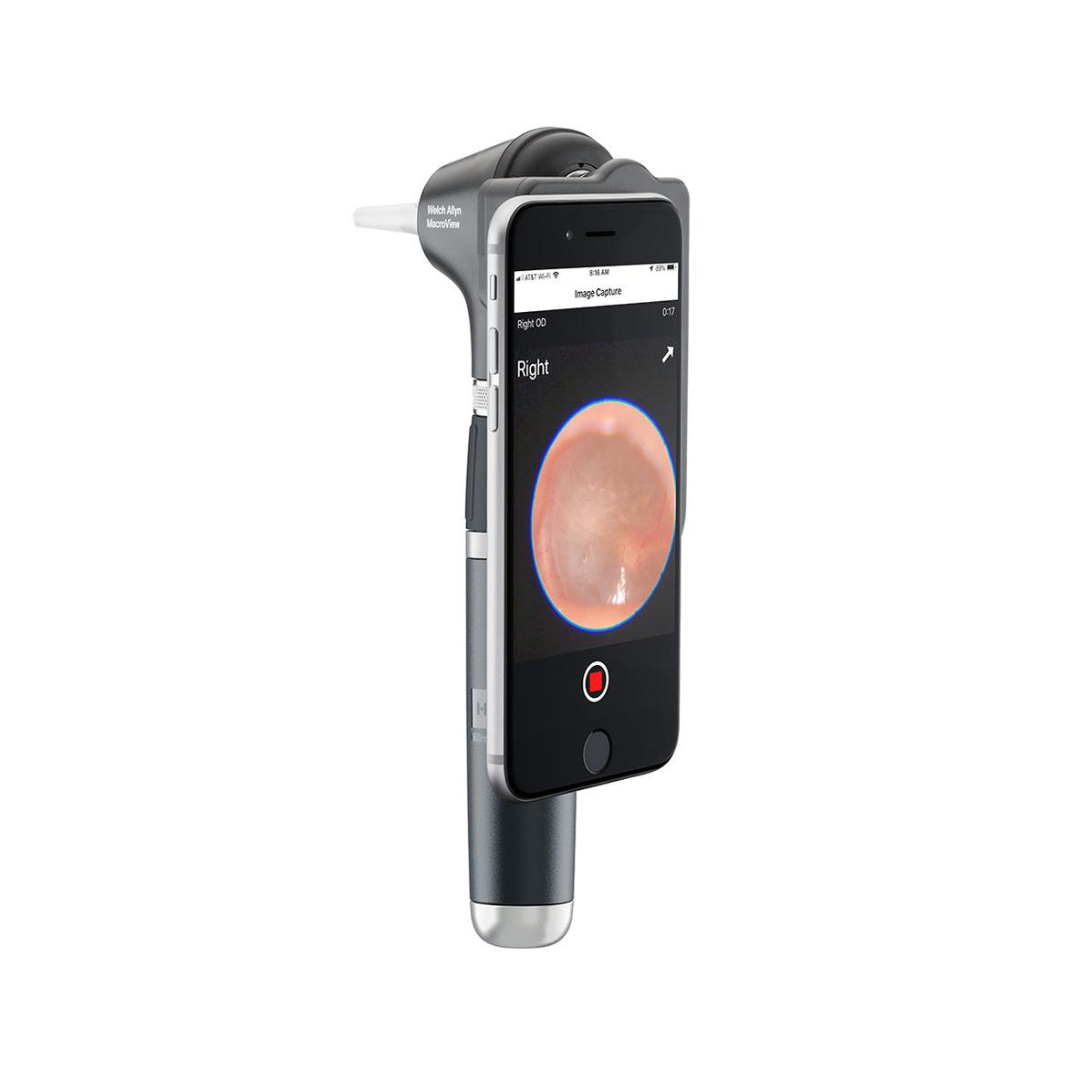 Otoscope Welch Allyn MacroView avec iExaminer main image 0