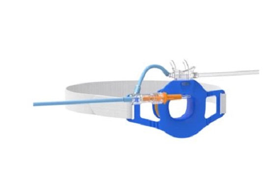 Flexicare Dual Capnography Cannulas and Masks Flyer - Dual Guard Cannula, Adult, Male Luer Lock, 10' - 032-10-855U