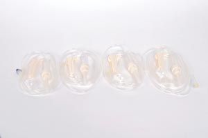 BD Dial-A Flow Administration Sets - Dial-A-Flow Administration Set, Needleless, Y-Site - MFS143