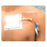 Integra LifeSciences  Fastener Catheter Cath-Strip 1/Pouch 50/Ca