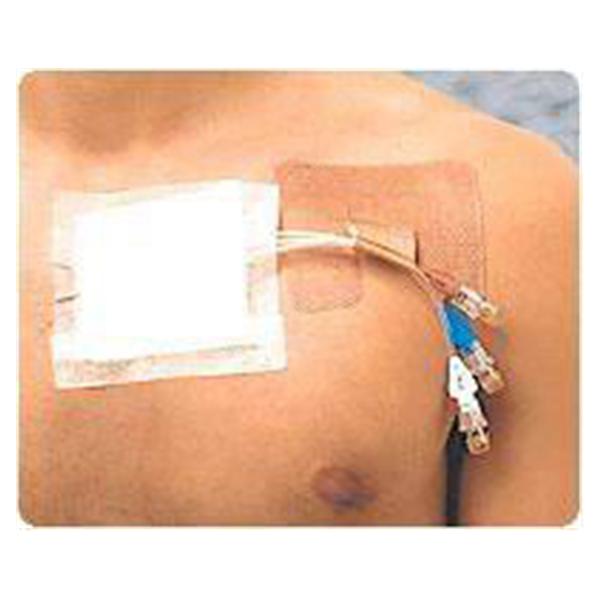 Integra LifeSciences  Fastener Catheter Cath-Strip 1/Pouch 50/Ca