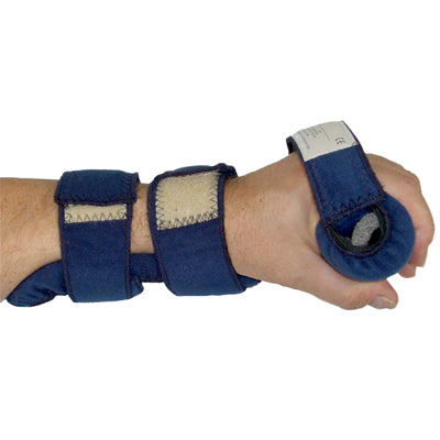 Splints 