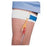 Bird & Cronin Tube Holder Leg Catheter Cath-Mate Ea