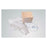 Vyaire Medical  Kit Suction Catheter Cath-N-Glove 12Fr Single/Economy 100/Ca