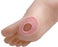 Adhesive Felt Corn Pad