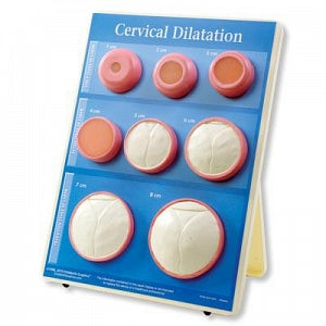 American 3B Scientific Cervical Dilation Easel Display - EDU, CERVICAL DIALTION EASEL DISPLAY - W43093
