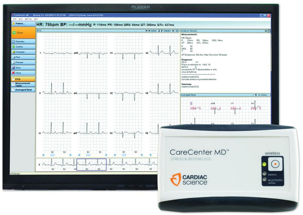 Burdick CareCenter MD Diagnostic Workstations - CareCenter MD Resting ECG and Stress Test Workstation, USB TM55 - CCMDTSBA1A