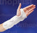 AliMed Orthoplast / Orthoplast II Splinting Material - Orthoplast II Splinting Material, Smooth Sheet - 4091