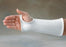 AliMed Polyform Splinting Material - Polyform Splinting Material - 4292