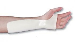 Alimed Radial Bar Wrist Precut Cock-Up Splints - Radial Bar Wrist Precut Cock-Up Splint, S / M - 5650