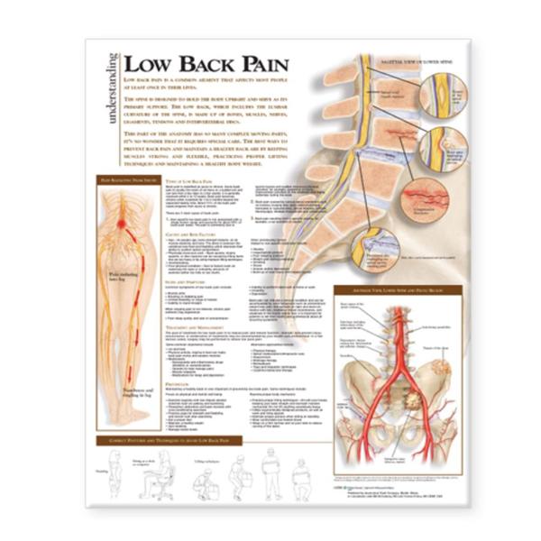 Wolters Kluwer Health  Chart Anatomical Understanding Pain 20x26" Ea