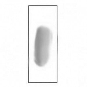 Azer Scientific Entameoba PVA Smear Stained Slide - SLIDE, ENTAMEOBA COLI, 2/PK - ESCS-158
