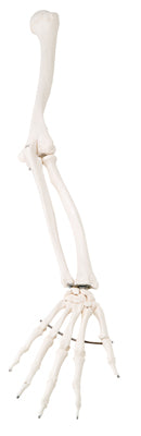 Arm Skeleton