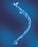 Adult Trach Care 24-Hr Double Swivel Elbow by Halyard Health