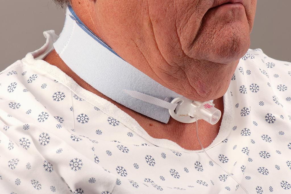 244 Blue Trach Tube Holders by Dale Medical