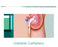 CR Bard Woven Ureteral Catheters - Ureteral Catheter, Olive Tip, 4 Fr - 136504