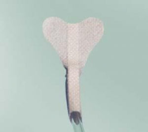 CR Bard StatLock Naso Stabilization Device - StatLock Nasogastric Stabilization Device with Attached Skin Prep - NG0120