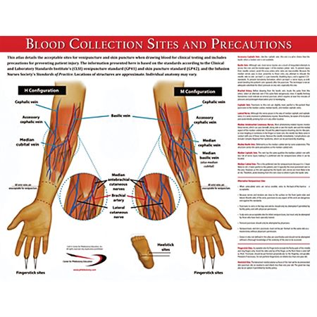 Blood Collection Sites Poster Blood Collection Sites Poster - 17"W x 22"H